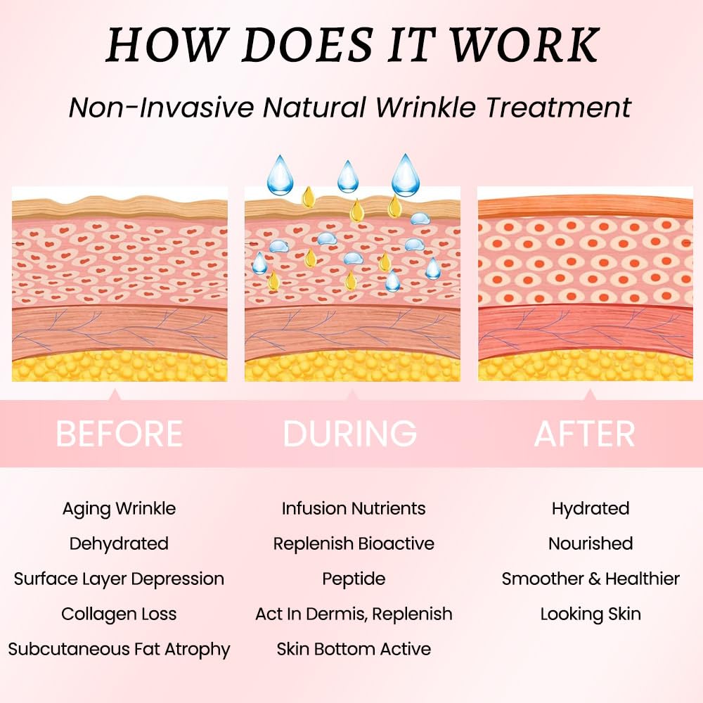 Kaely 192 Pcs Wrinkle Patches for Face Overnight, Silicone Scar Tape for Wrinkles Forehead, Face Tape for Wrinkles Overnight Sleeping Lifting Sagging Skin, Smile Line Facial Smoothing